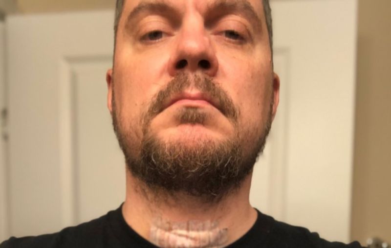 Chimaira lead singer Mark Hunter diagnosed with cancer