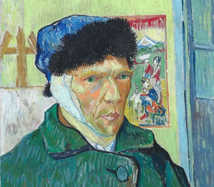 Tracing the legacy of Vincent van Gogh’s ear