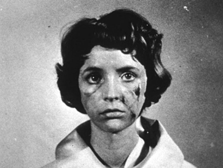 Revisiting the French horror classic 'Eyes Without A Face'