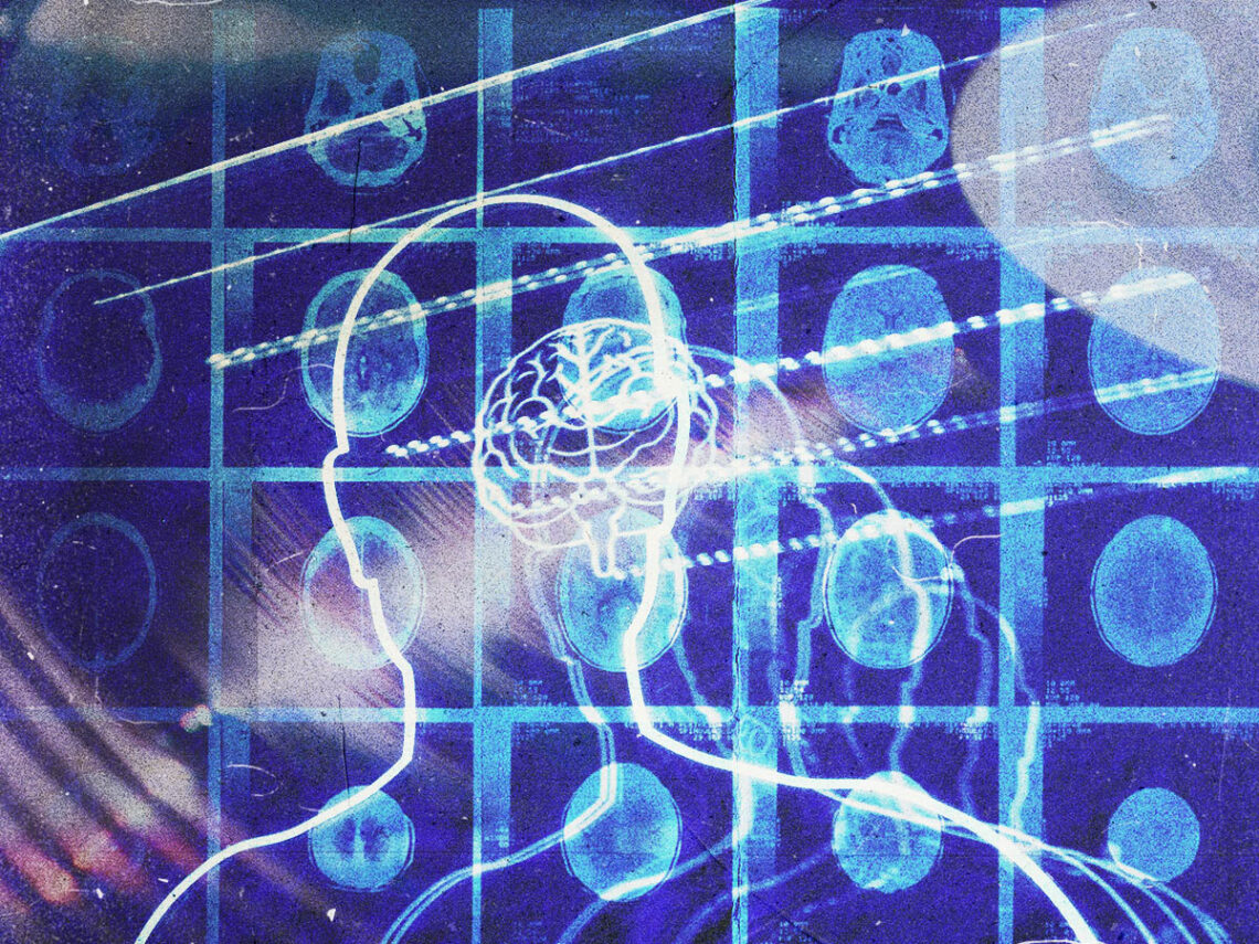 The album designed to mimic schizophrenia