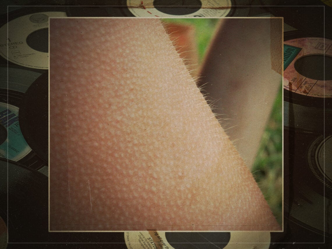 The science behind why music gives some people goosebumps